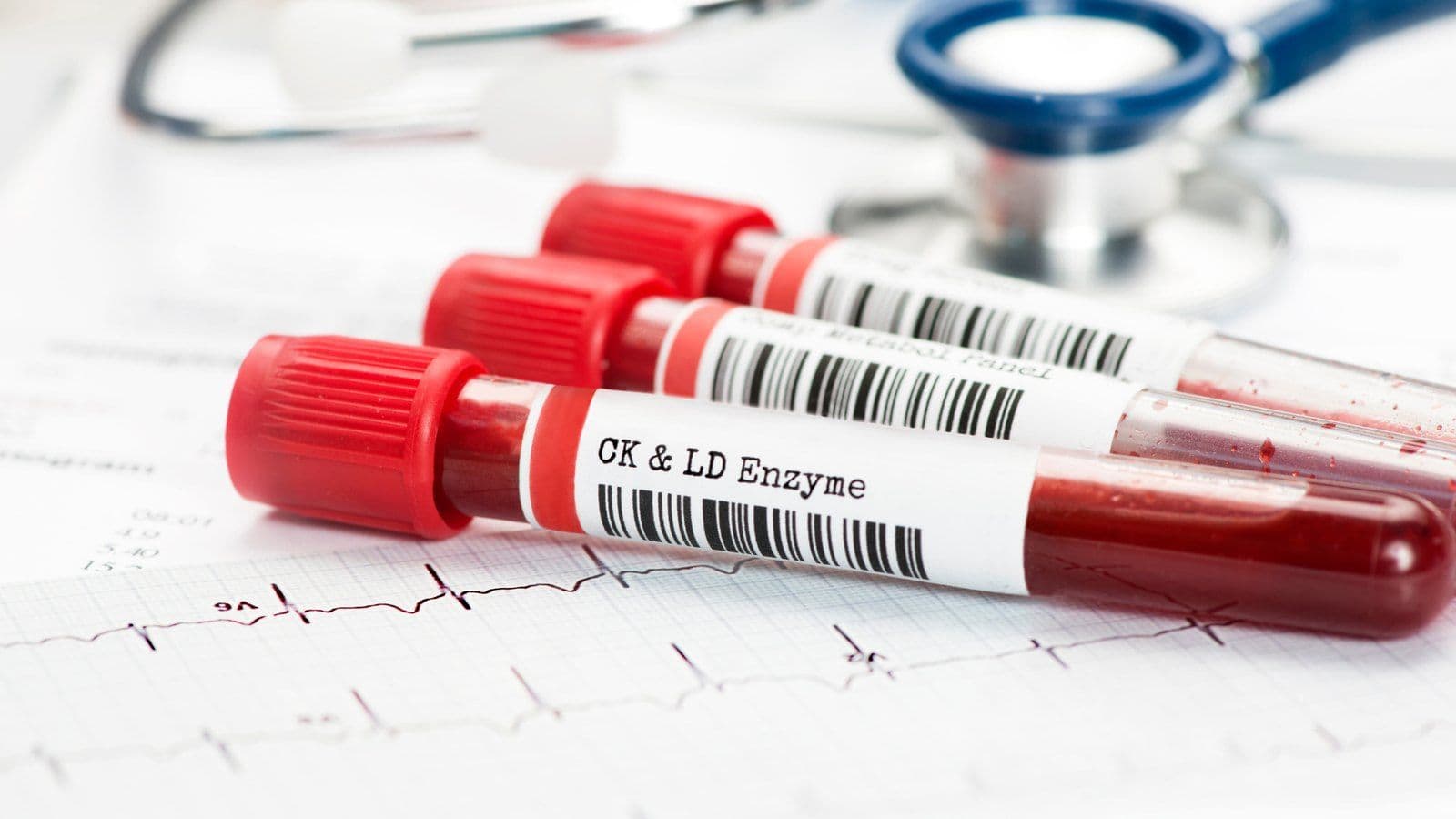 Tubes de prelevement sanguin etiquetes poses sur un trace d'electrocardiogramme