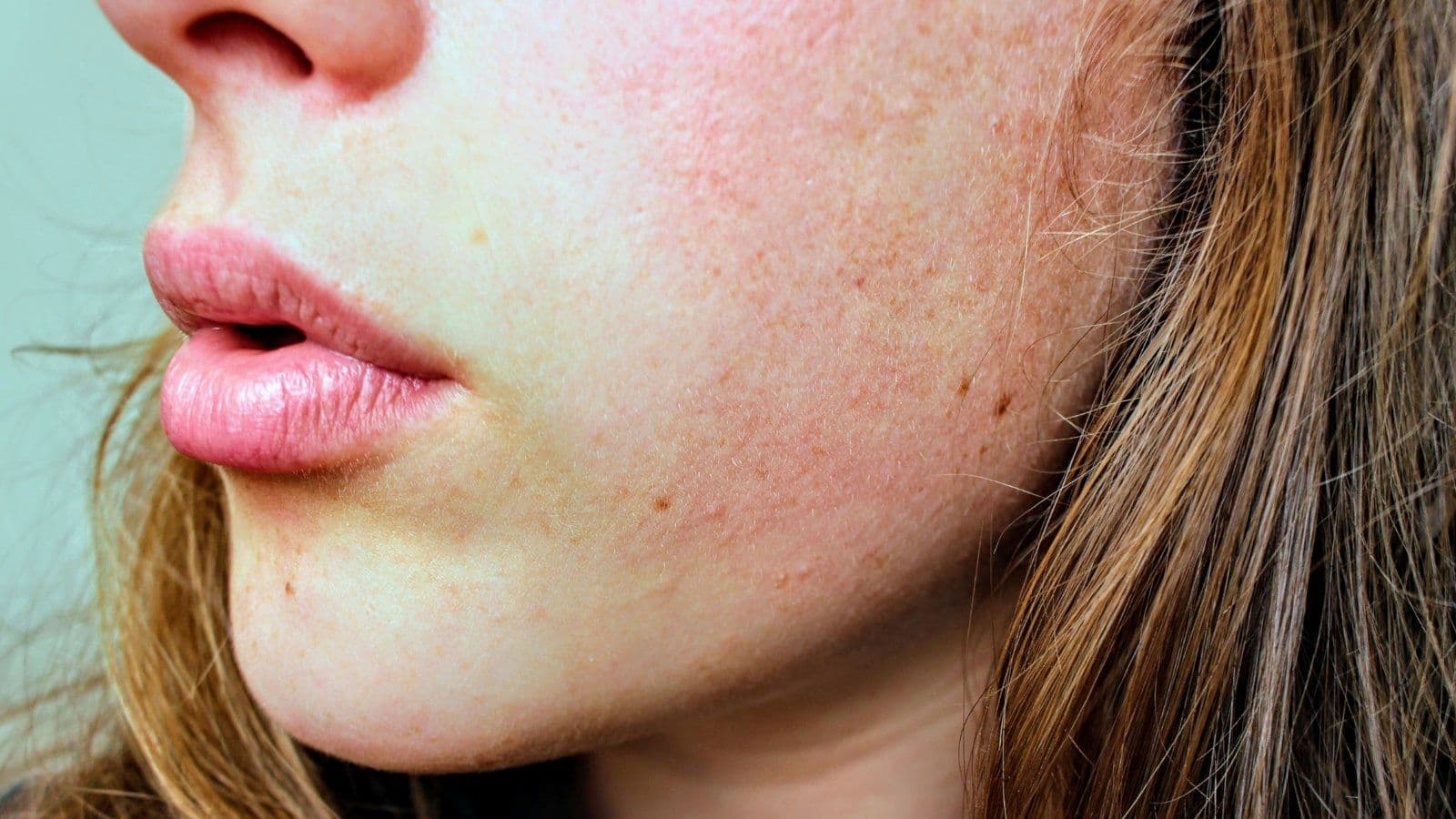 Visage clair avec taches de rousseur, illustration sur le phototype